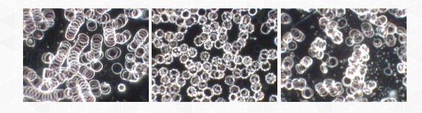 photo du sang microscope fond noir sang exposé ondes wifi telephone mobile
